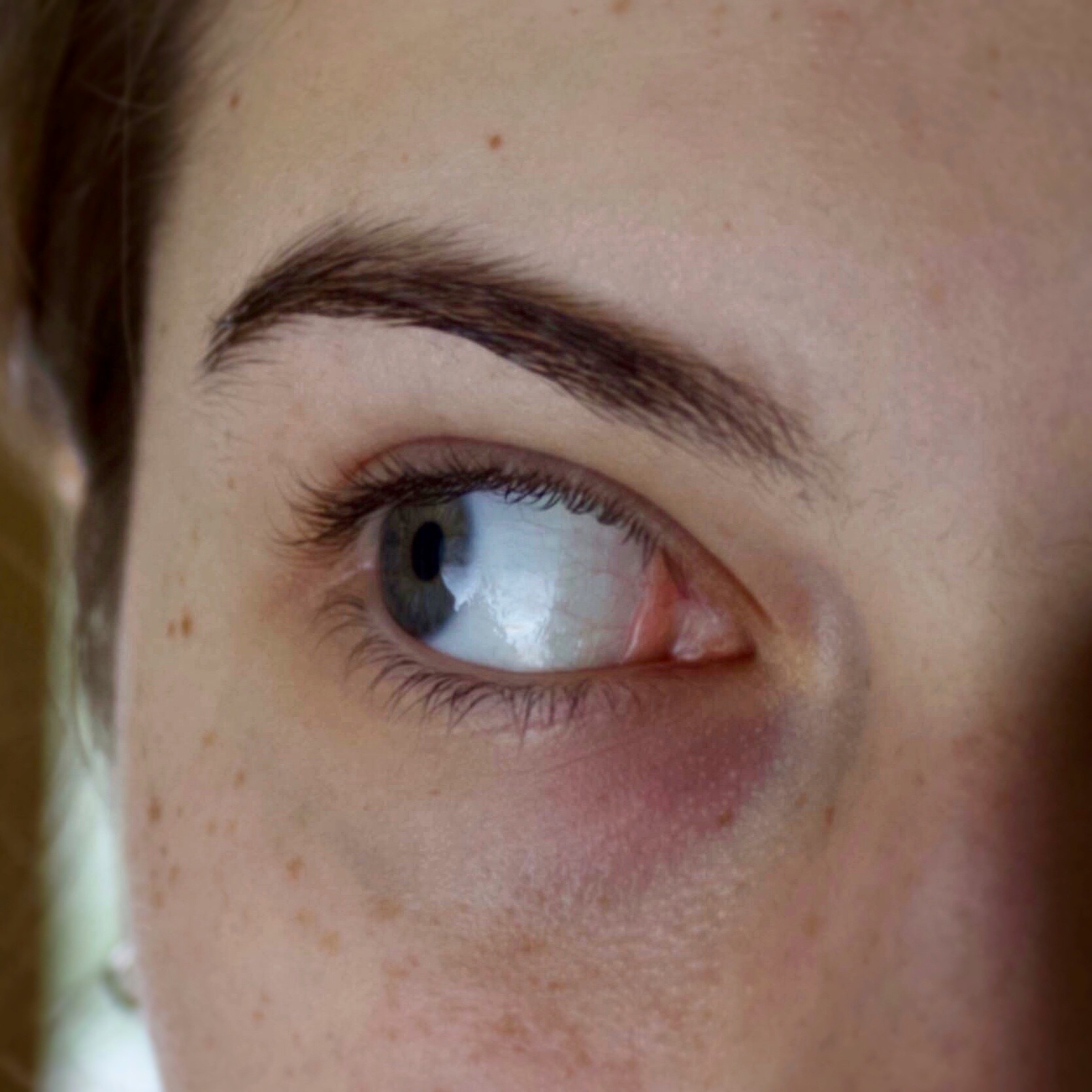 photograph of an eye looking to the left