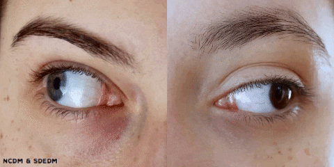 Animation of two different people's eyes looking out as far as possible and slowly crossing